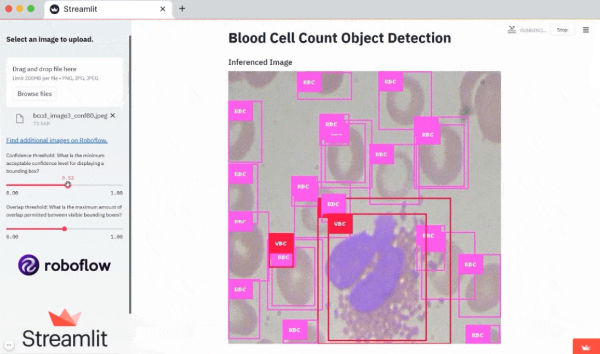 Building an app for blood cell count detection